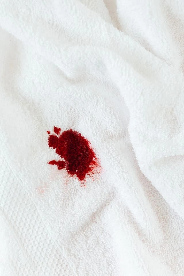 How To Get Blood Out Of Carpet 3